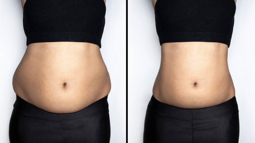 Weight Loss Clinic Houston