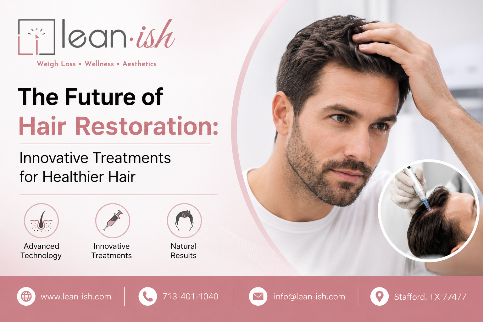 hair restoration houston texas
