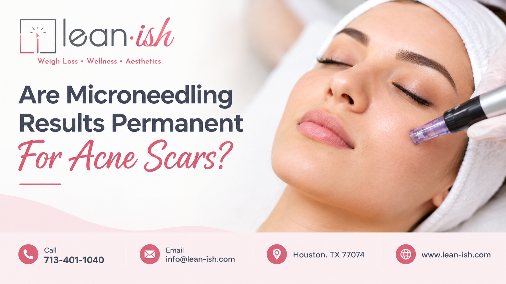 Are Microneedling Results Permanent for Acne Scars