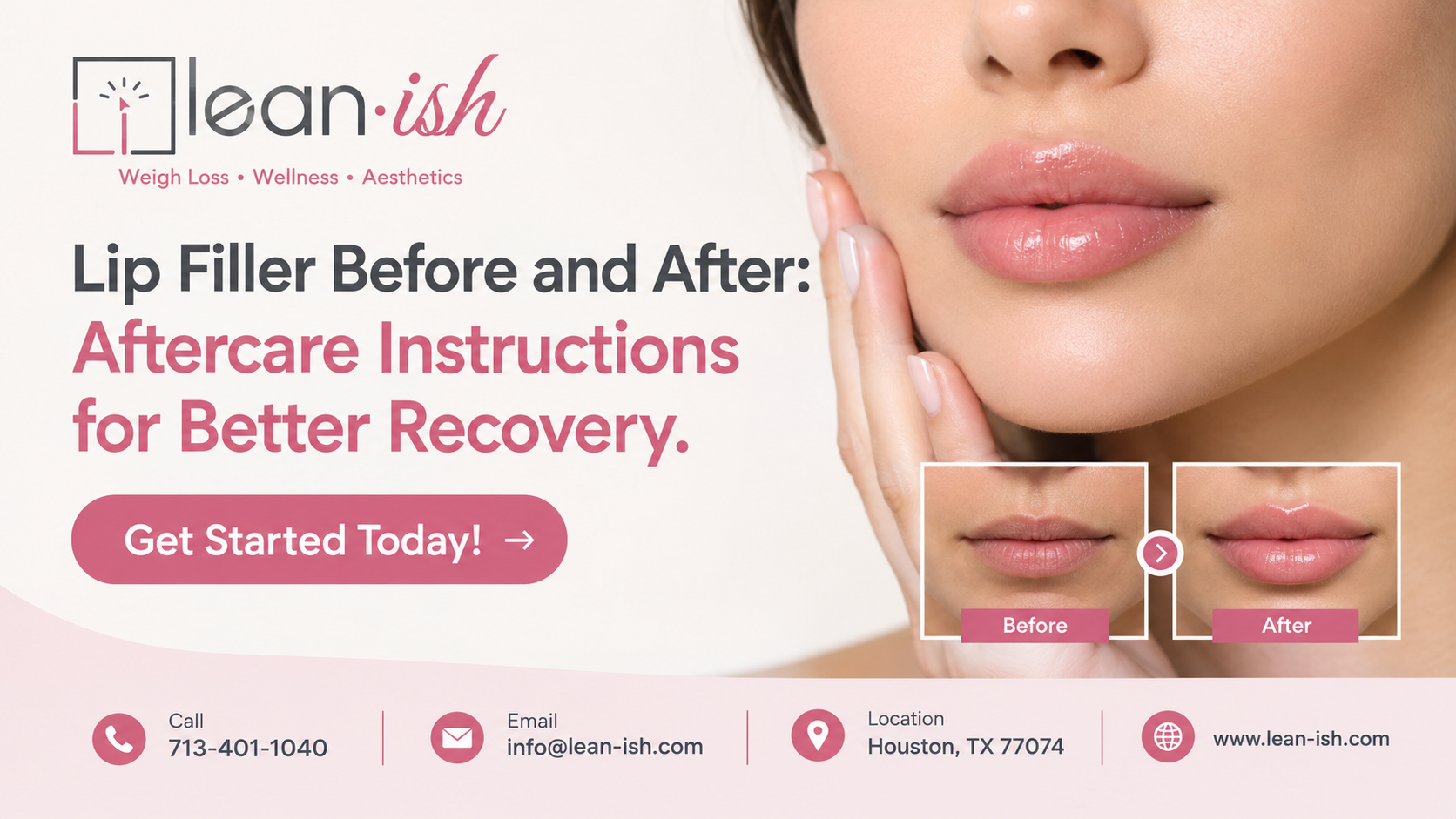 Lip filler before and after
